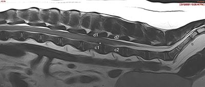 Comparison of Surgical Outcomes Associated With Compression Secondary to Hemorrhage and Intervertebral Disk Extrusions in Dogs